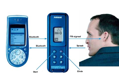Figuur 9: FM-geluidsoverdrachtsysteem voor gsm